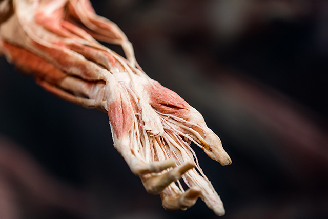 Blood Donor Arm
