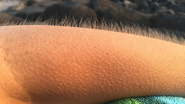 Goosebumps Overview